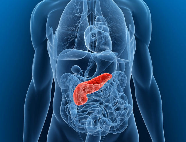 cancer-de-pancreas