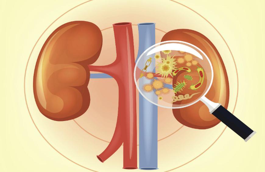 infeccao-renal-parece