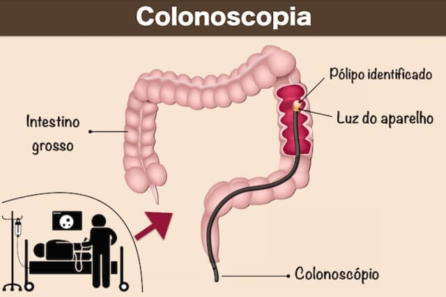 logo-pode-comer-colonoscopia