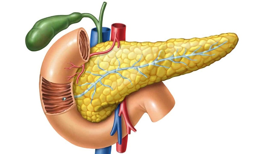 pancreatite necrosante