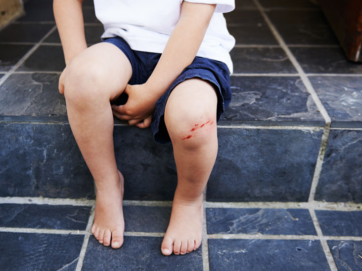 tratar cortes e arranhoes